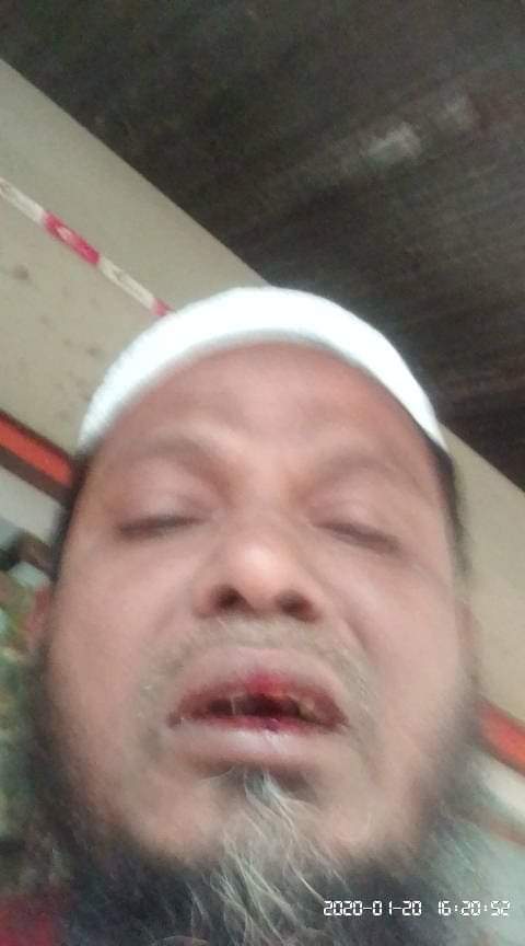 মাদরাসা শিক্ষকের ওপর হামলা, মামলা করতে দেয়নি স্থানীয় মেম্বার মাদরাসা শিক্ষকের ওপর হামলা, মামলা করতে দেয়নি স্থানীয় মেম্বার
